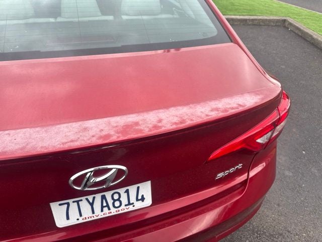 2016 Hyundai Sonata Sport